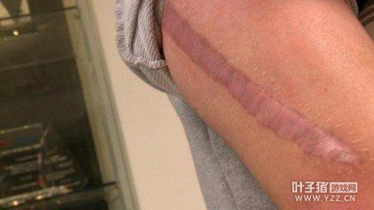 �羺ѡ�ֶ����˲����� Uzi��ֹʹҩ�����ϳ�