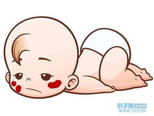 为你全面解析婴儿血管瘤的种种症状!