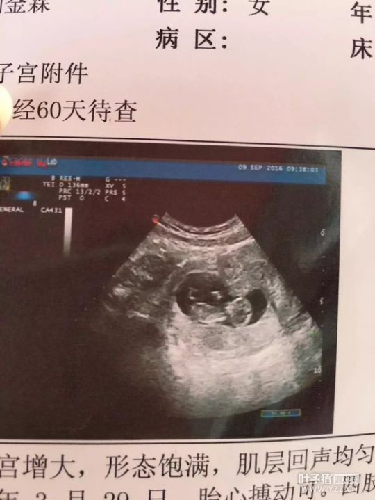 详情