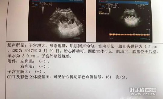 详情